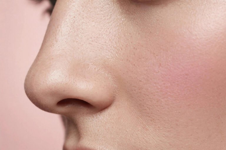 Why Does My Makeup Separate Around My Nose? Causes and Fixes